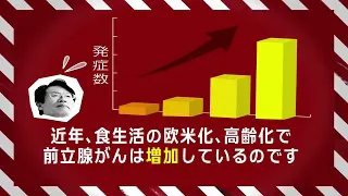 前立腺がんの検診を受けてますか？